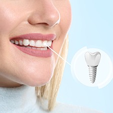 woman smiling after getting dental implants in Richmond