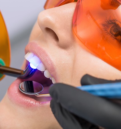 Closeup of dentist using special light during treatment