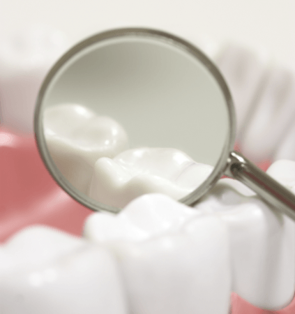 Closeup of smile with metal free dental restoration