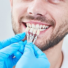 Man having his teeth color-matched for cosmetic dentistry in Richmond, VA