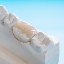 a customized dental crown 