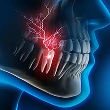 X-ray diagram of a toothache in Richmond