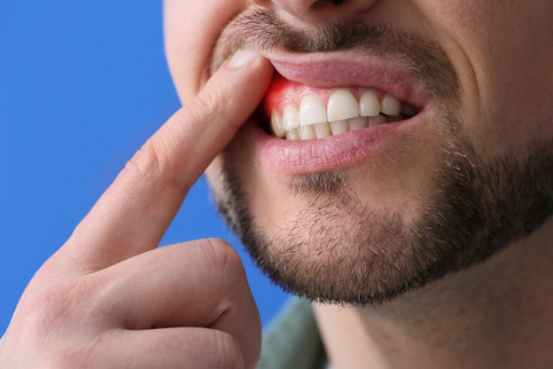 Patient in Tuckahoe checking gum health