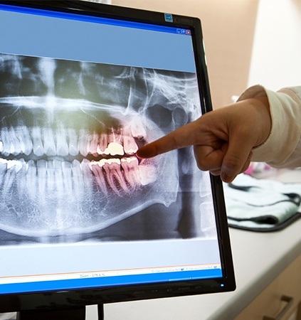 Digital x-rays on tablet computer