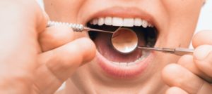 Closeup of patient during routine dental checkup from Richmond dentist 