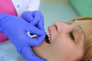 Woman with blond hair having a veneer placed on her tooth by a dentist wearing blue gloves.