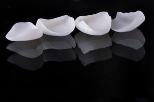 Four veneers sitting in a row on a black surface